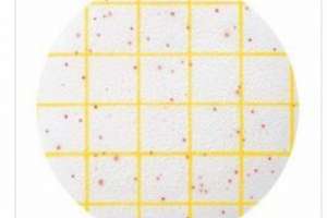 Aerobic Count Plate